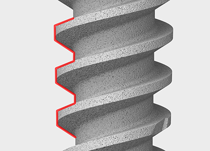 crestone reverse buttress